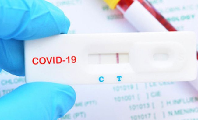 Закупили COVID-тесты по вдвое большей цене: будут судить работницу коммунального предприятия