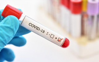 В Україні зростає кількість хворих на COVID-19, — головний санітарний лікар