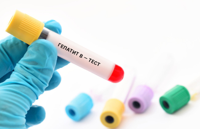 Вспышка гепатита в Виннице: 100 больных с подозрением на гепатит А госпитализированы в больницы