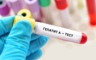 Загроза спалаху гепатиту А у Києві: що варто знати