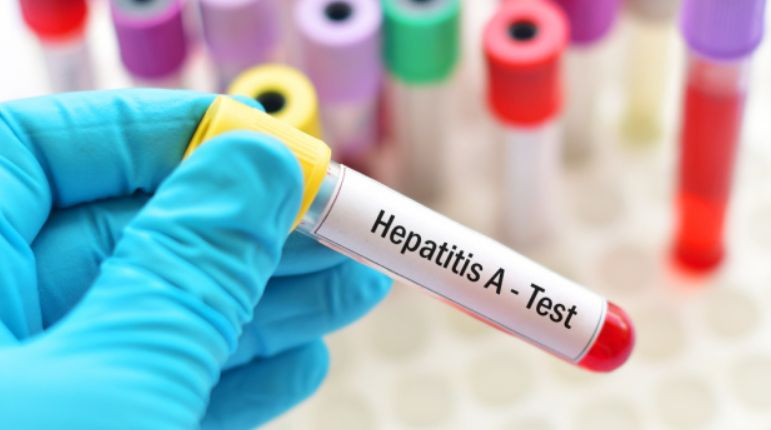 Гепатит А також виявили в Івано-Франківську: серед інфікованих – діти