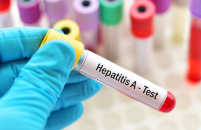 Гепатит А также обнаружили в Ивано-Франковске: среди инфицированных – дети