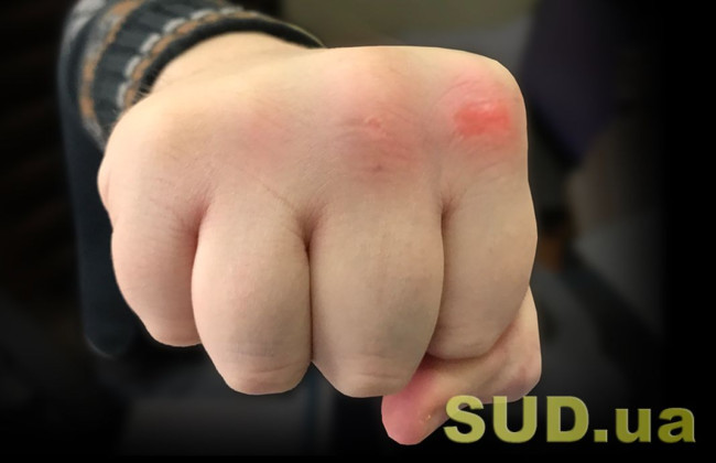 В Житомире мужчина избил работника ТЦК: инцидент попал на видео