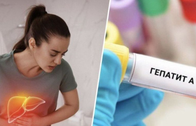 Может ли инфицированный гепатитом А работник продолжать работать: разъяснение Гоструда