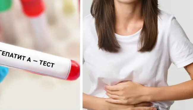 Кто в зоне риска инфицирования гепатитом А: список работников