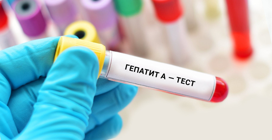 В Киевской области обнаружили случай заболевания вирусным гепатитом А: что известно