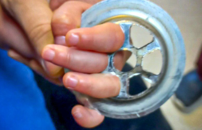 В Киеве спасатели помогли ребенку, у которого рука застряла в раковине