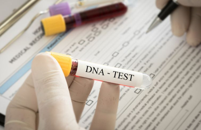 Украинцы могут сдать ДНК за рубежом для поиска пропавших без вести родных