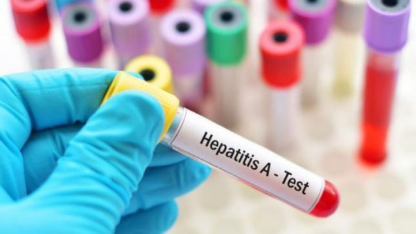 Вспышка гепатита A в Винницкой области ликвидирована – Минздрав