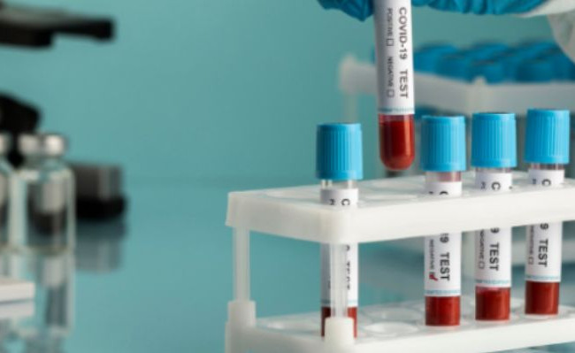 Стало известно, сколько случаев коронавируса «Pirola» зарегистрировано в Украине в декабре