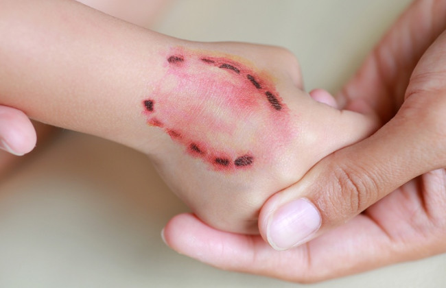 На Львовщине больная собака покусала троих человек – до 8 марта введен карантин