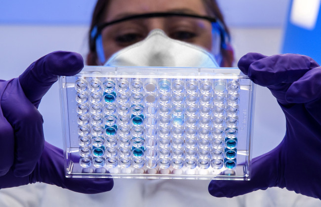 У украинцев за границей остался последний день на онлайн-запись для сдачи образцов ДНК