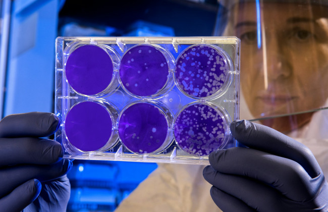 «Болезнь Х» – в Минздраве объяснили, что это такое и как Украина готовится к потенциальной угрозе