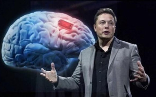 Компания Neuralink Илона Маска впервые ввела электронный чип в человеческий мозг