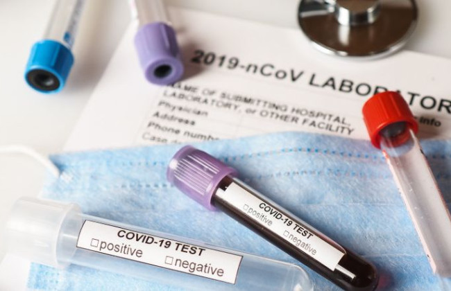 От коронавируса за неделю умерли 34 украинца – Минздрав