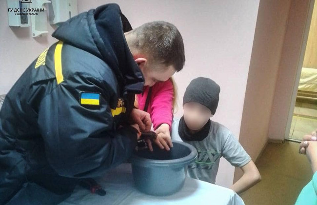 На Киевщине подросток засунул палец в мультитульный ключ: врачи обратились к ГСЧС