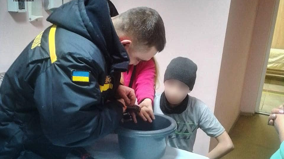 На Киевщине подросток засунул палец в мультитульный ключ: врачи обратились к ГСЧС