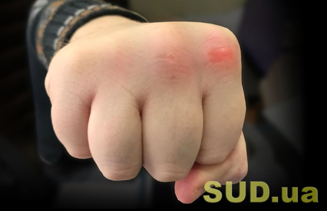 В Кривом Роге охранник предприятия избил оператора телеканала «Рада» – ему сообщили о подозрении