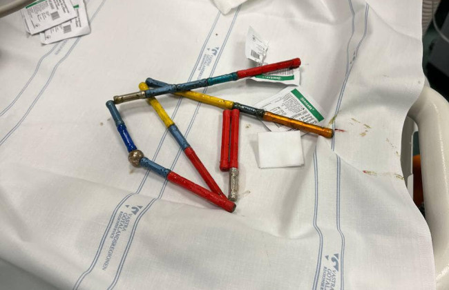 В Охматдете врачи спасли ребенка, который проглотил 20 магнитов