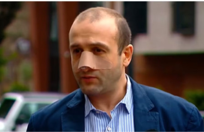 Лидера оппозиции в Грузии избили в собственном офисе: подробности нападения