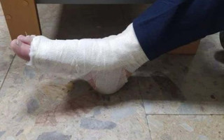 На Тернопільщині чоловік, викрадаючи велосипед, зламав ногу