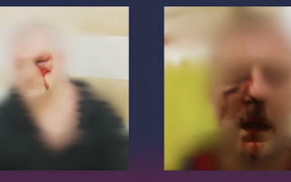 Под Киевом соседи в жилом комплексе избили гомосексуальную пару