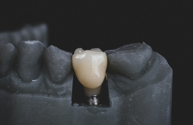 Услуги бесплатного зубопротезирования ветеранам смогут предоставлять уже 48 медучреждений