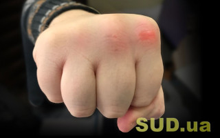 У київській школі однокласники жорстоко побили хлопця: у підлітка діагностували розрив яєчка