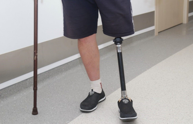 Военнослужащие смогут получать высокофункциональные протезы быстрее: решение Правительства