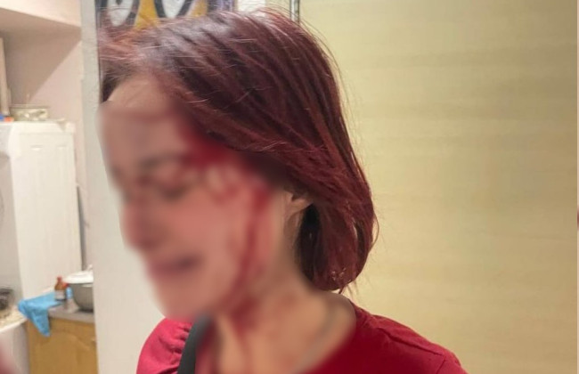 Избиение 19-летней девушки мужчиной в военной форме: Одесский ТЦК начал служебную проверку