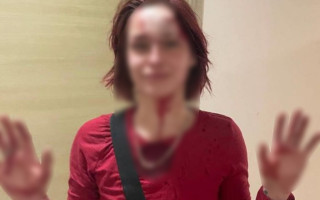«Залила» таксиста газовим балончиком та розбила скло у відділку поліції: справу побиття 19-річної одеситки розслідує поліція