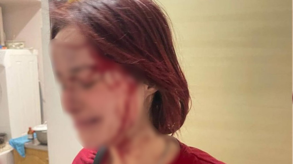 Избиение 19-летней девушки мужчиной в военной форме: Одесский ТЦК начал служебную проверку