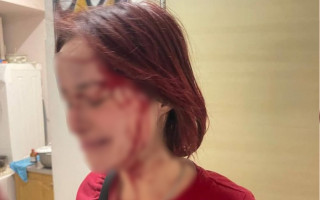 Побиття 19-річної дівчини чоловіком у військовій формі: Одеський ТЦК розпочав службову перевірку
