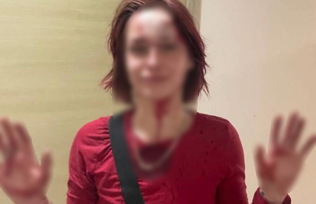 «Залила» таксиста газовым баллончиком и разбила стекло в отделении полиции: дело избиения 19-летней одесситки расследует полиция