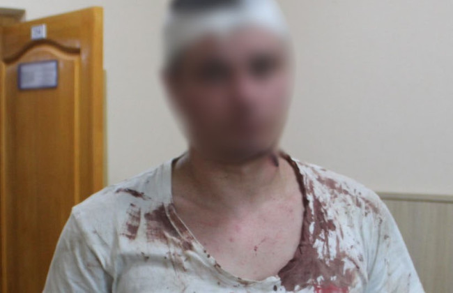 В Киеве мужчина тяжело травмировал своего товарища ножом во время посиделок в гараже