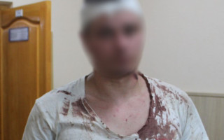 У Києві чоловік тяжко травмував свого товариша ножем під час посиденьок в гаражі