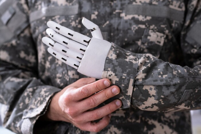 Бесплатное протезирование для военнослужащих: какие документы нужны
