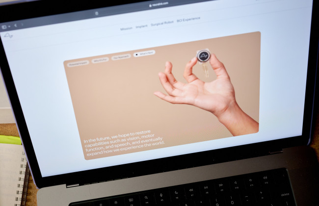 Илон Маск анонсировал имплантацию чипа Neuralink второму пациенту
