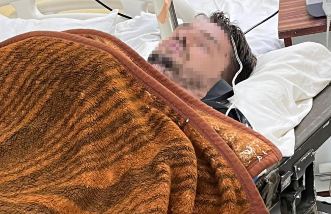 Путешествие едва не закончилось трагедией: пограничники спасли мужчину в Карпатах