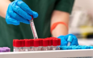 У Європі вперше зареєстрований «вірус лінивця», який переноситься комарами