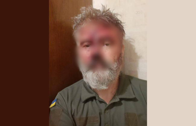 В Киеве неизвестные избили митрополита ПЦУ, который также является военным ВСУ