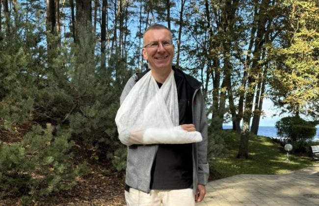 Президент Латвии Эдгар Ринкевич упал с велосипеда и сломал руку