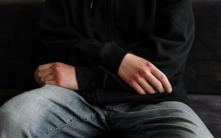 У Хмельницькому в гуртожитку жорстоко побили 15-річного студента — підліток отримав підозру