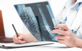 В Британии искусственный интеллект поможет врачам выявлять переломы на рентгеновских снимках