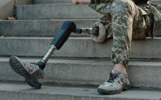 Мінсоцполітики підвищило граничні ціни на протези для військових