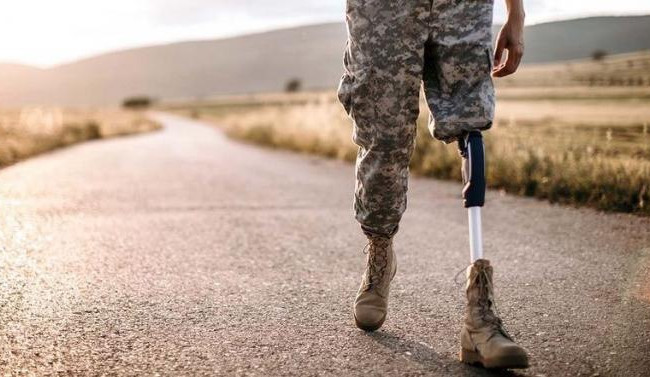 Участники боевых действий получат упрощенный доступ к высокотехнологичным протезам