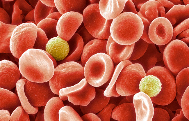 Вчені виявили нову групу крові, що не має антигену AnWj