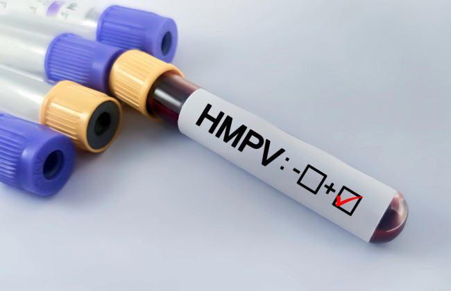 Британські вірусологи закликали Китай надати більше даних про метапневмовірус