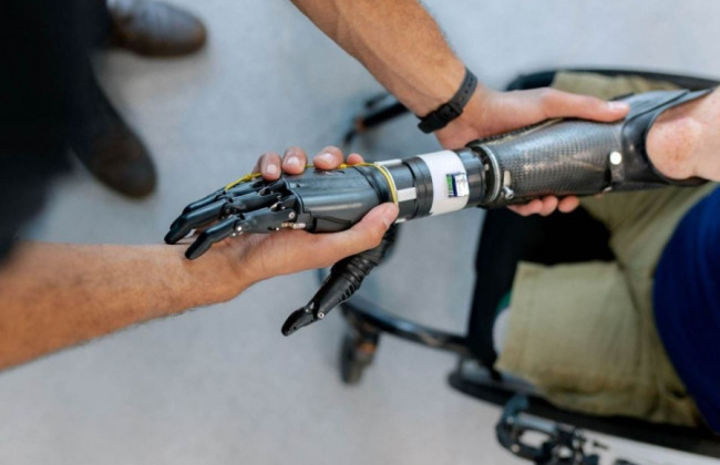 В Україні за підтримки Уряду запускають платформу про державну програму протезування