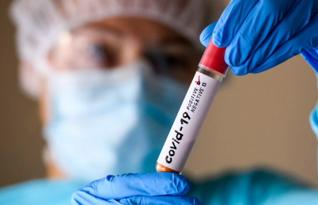 Коронавирус, скорее всего, возник из лаборатории, а не от животных — считает ЦРУ